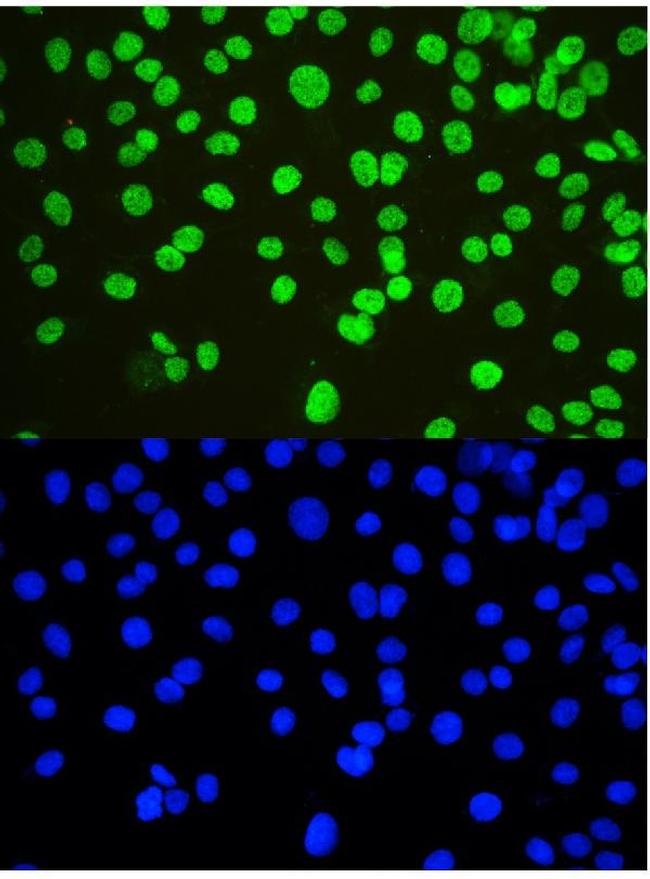 NONO Antibody in Immunocytochemistry (ICC/IF)