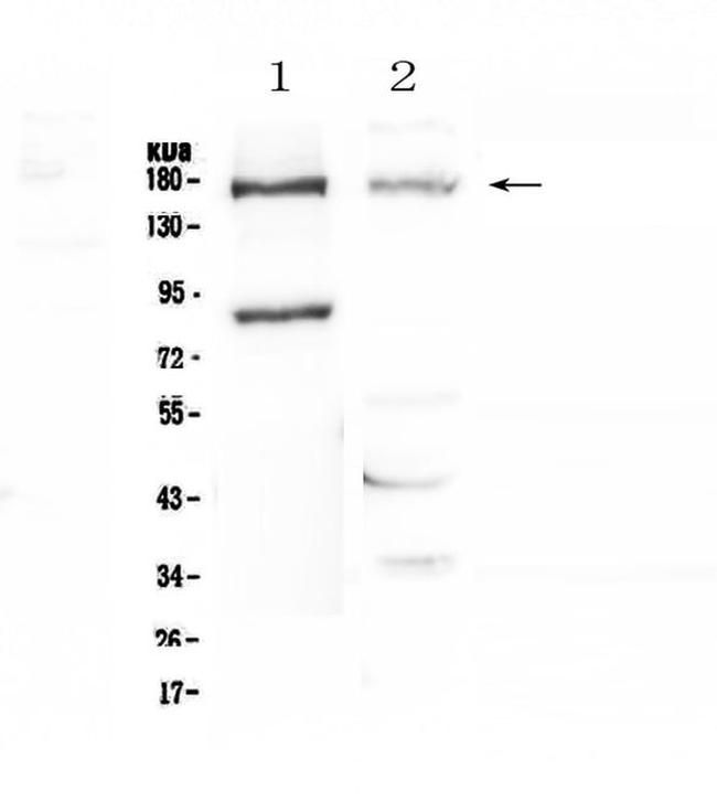 NPC1 Antibody in Western Blot (WB)