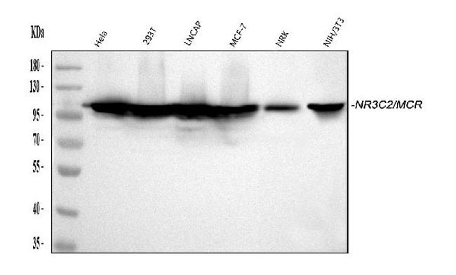 NR3C2 Antibody in Western Blot (WB)