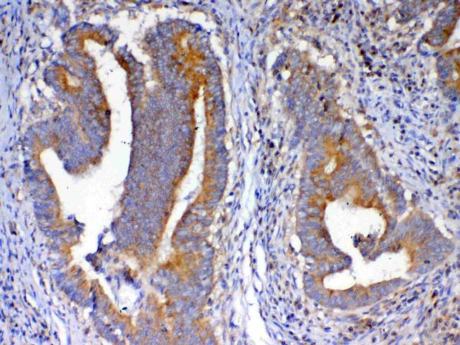 NSF Antibody in Immunohistochemistry (Paraffin) (IHC (P))