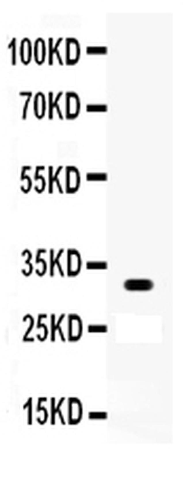 OTX2 Antibody in Western Blot (WB)