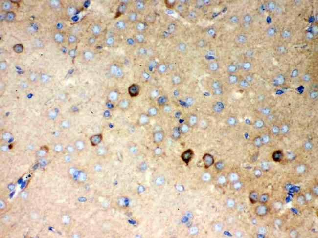 P2X5 Antibody in Immunohistochemistry (Paraffin) (IHC (P))