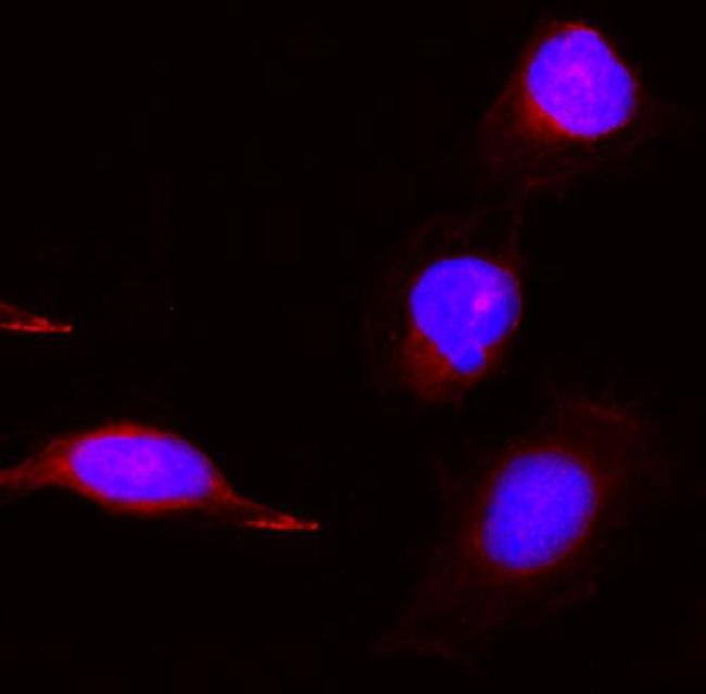 PBK Antibody in Immunocytochemistry (ICC/IF)