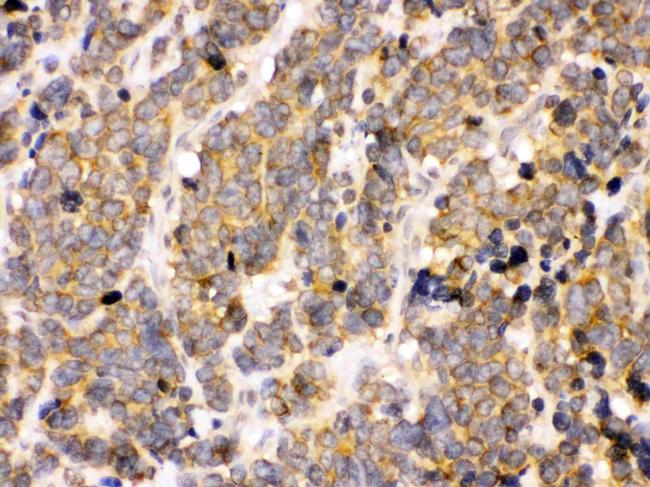 PDPK1 Antibody in Immunohistochemistry (Paraffin) (IHC (P))