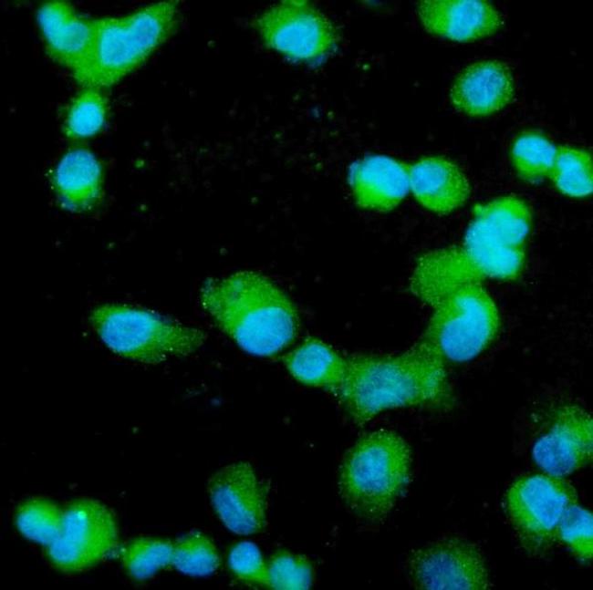 Profilin 2 Antibody in Immunocytochemistry (ICC/IF)