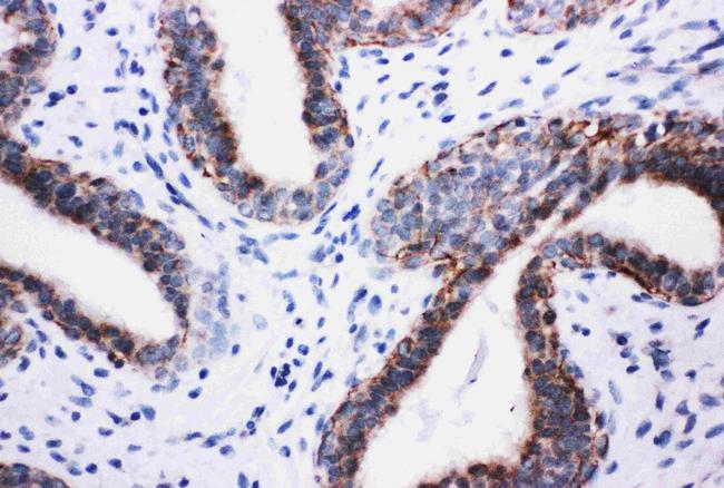 PIK3R2 Antibody in Immunohistochemistry (Paraffin) (IHC (P))