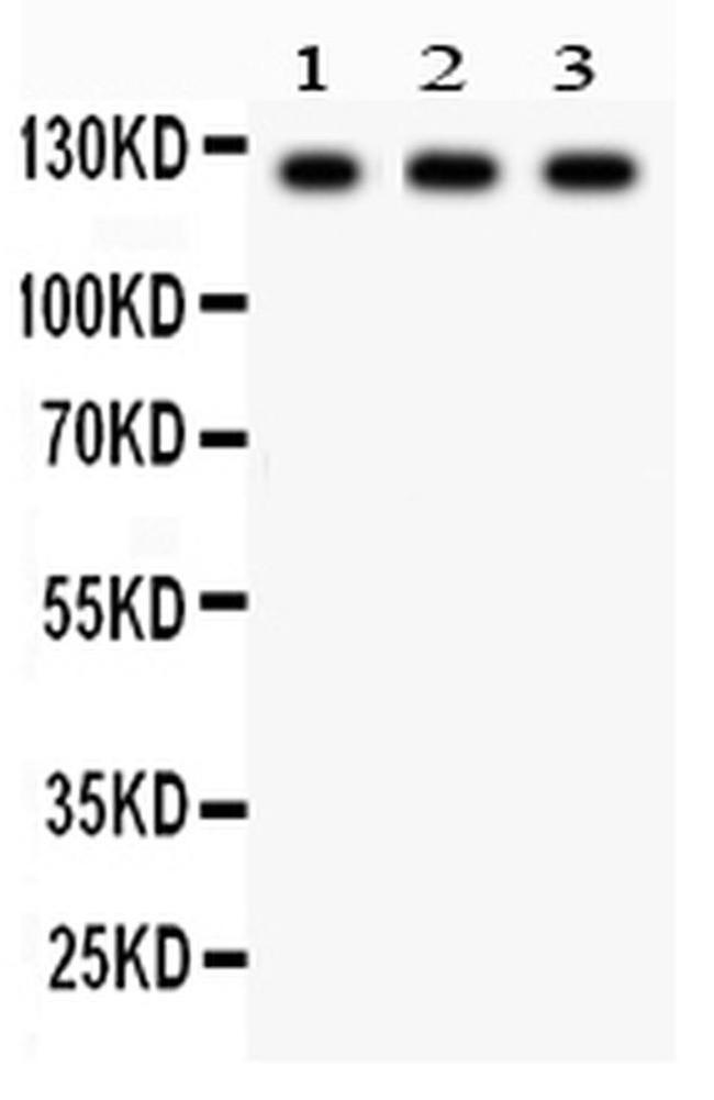 PLD1 Antibody in Western Blot (WB)