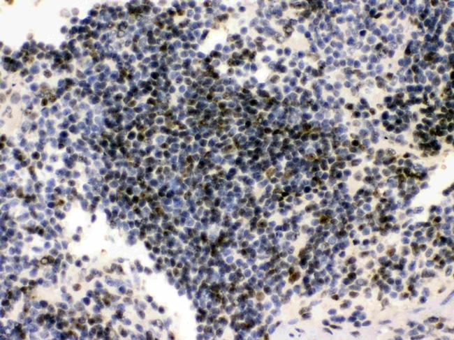 PML Antibody in Immunohistochemistry (Paraffin) (IHC (P))