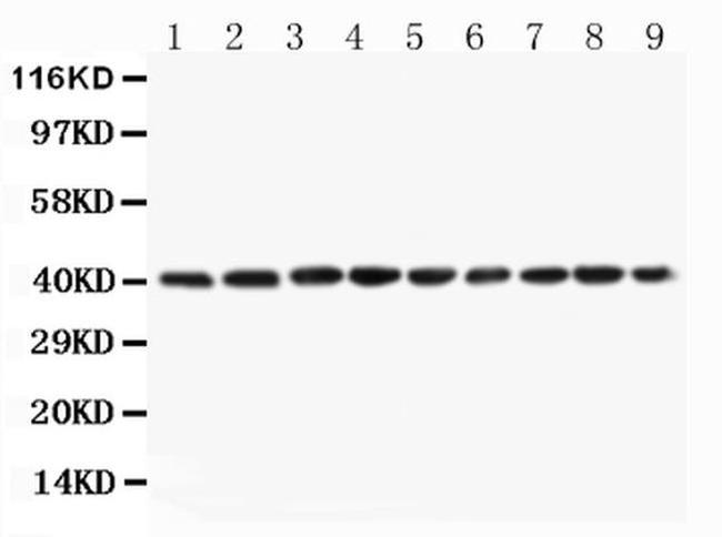 PON1 Antibody in Western Blot (WB)