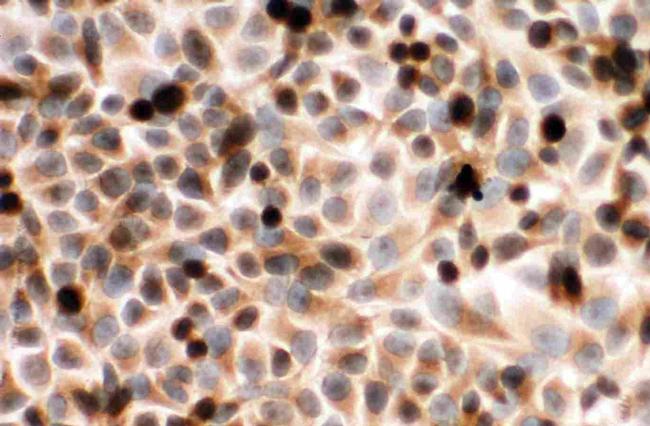 Cytochrome P450 Reductase Antibody in Immunocytochemistry (ICC/IF)