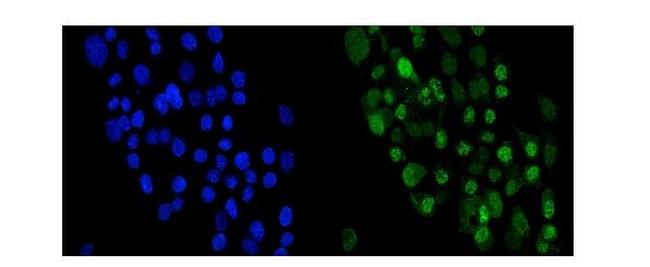 Periplakin Antibody in Immunocytochemistry (ICC/IF)