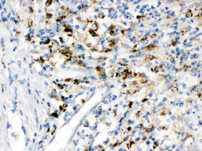 PPT1 Antibody in Immunohistochemistry (Paraffin) (IHC (P))