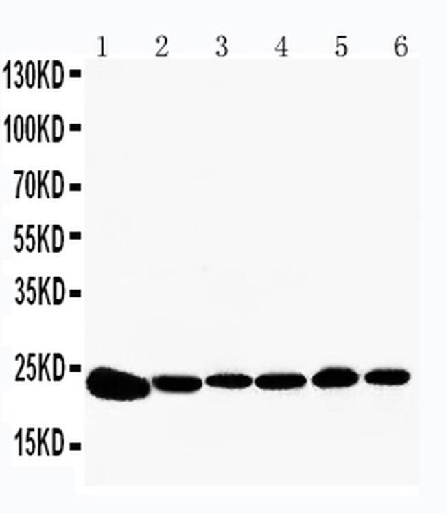 PRDX2 Antibody in Western Blot (WB)