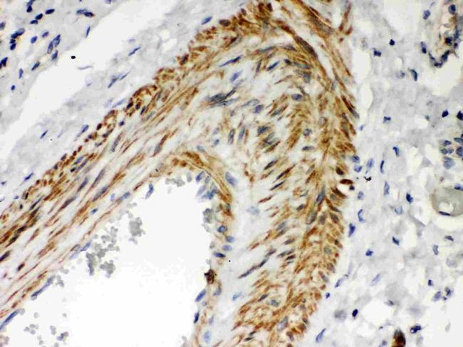 PKC lambda/iota Antibody in Immunohistochemistry (Paraffin) (IHC (P))