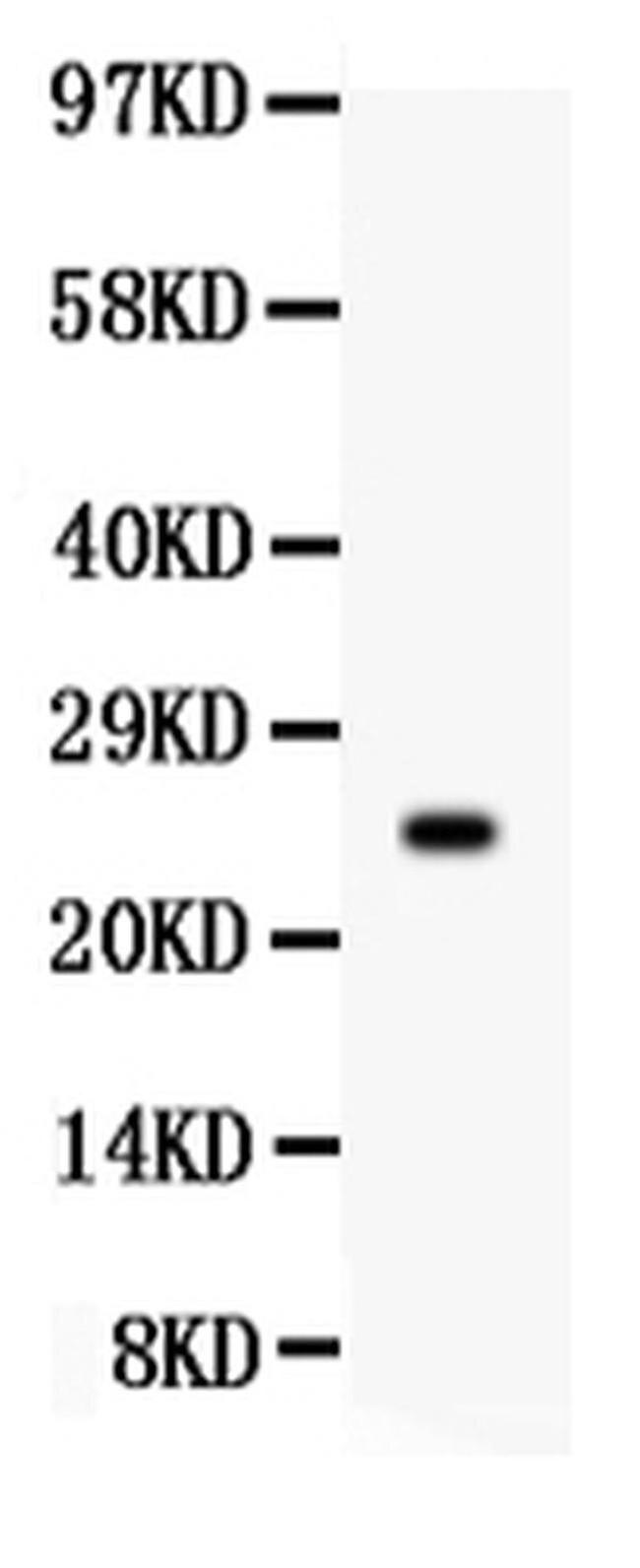 Prolactin Antibody in Western Blot (WB)