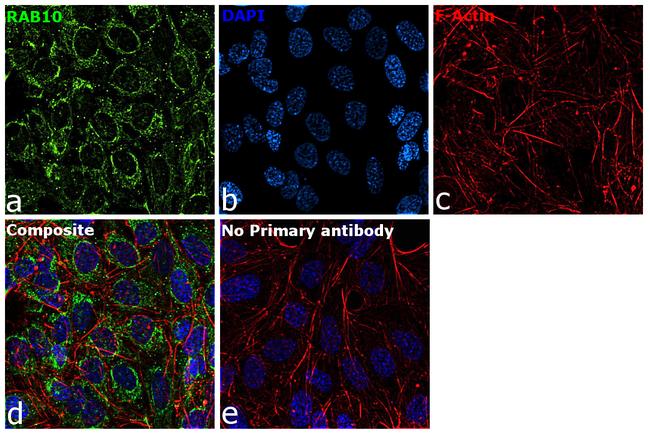 RAB10 Antibody in Immunocytochemistry (ICC/IF)