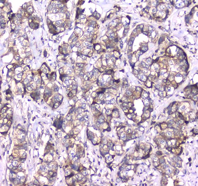 RAB27A Antibody in Immunohistochemistry (Paraffin) (IHC (P))