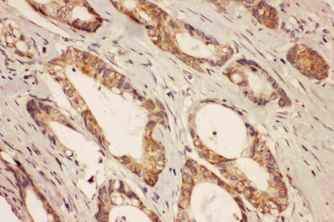 RAB8A Antibody in Immunohistochemistry (Paraffin) (IHC (P))