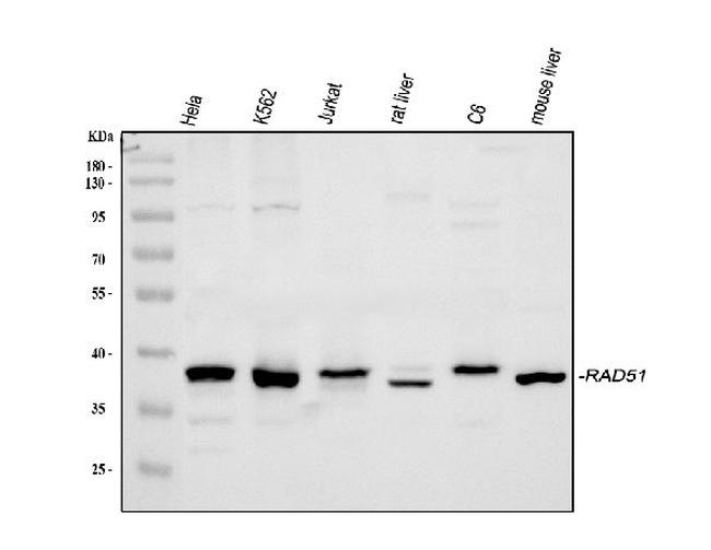 RAD51 Antibody in Western Blot (WB)