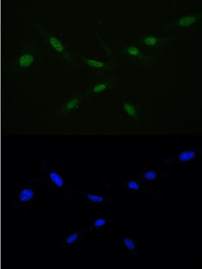 RAN Antibody in Immunocytochemistry (ICC/IF)