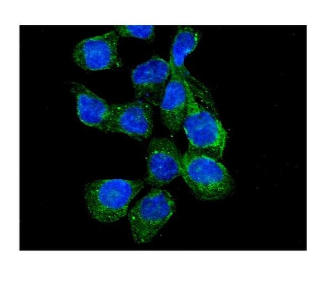 RASA1 Antibody in Immunocytochemistry (ICC/IF)