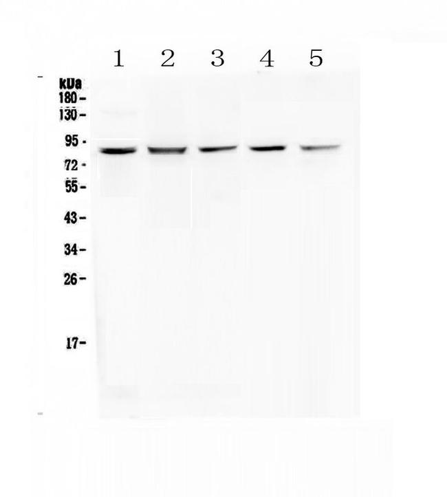 RNF43 Antibody in Western Blot (WB)