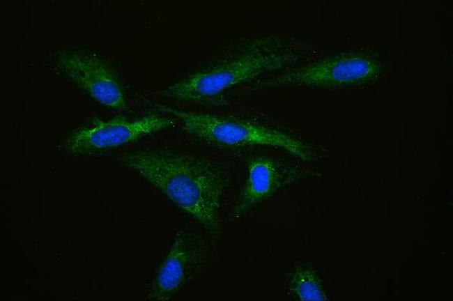 MPS1 Antibody in Immunocytochemistry (ICC/IF)