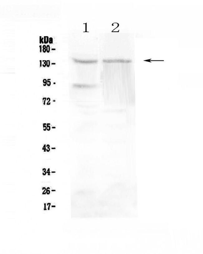 RTEL1 Antibody in Western Blot (WB)