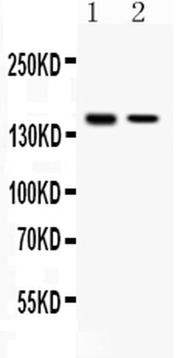 SAFB Antibody in Western Blot (WB)