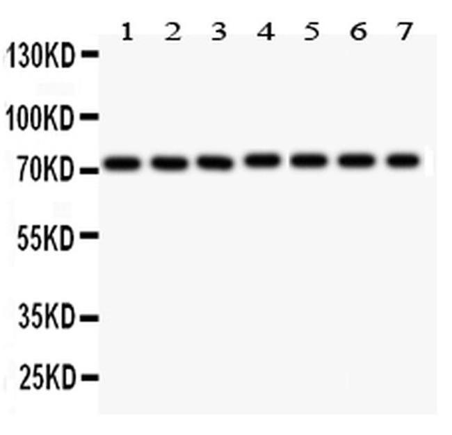 SDHA Antibody in Western Blot (WB)