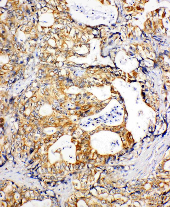 SDHC Antibody in Immunohistochemistry (Paraffin) (IHC (P))