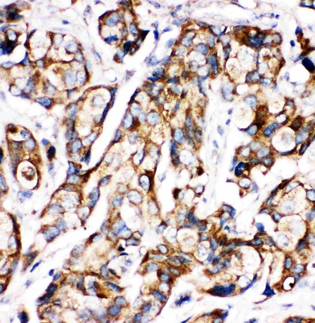 SHH Antibody in Immunohistochemistry (Paraffin) (IHC (P))