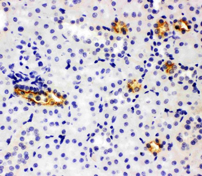 SLC12A1 Antibody in Immunohistochemistry (Paraffin) (IHC (P))