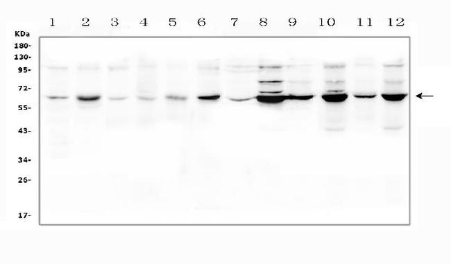 SLC19A1 Antibody in Western Blot (WB)