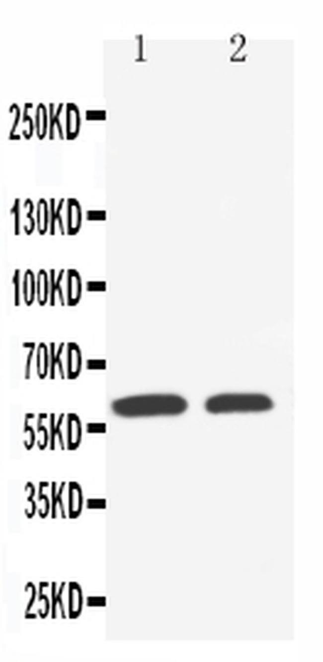 SLC22A1 Antibody in Western Blot (WB)