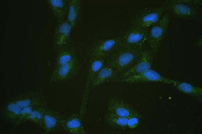 GLUT5 Antibody in Immunocytochemistry (ICC/IF)