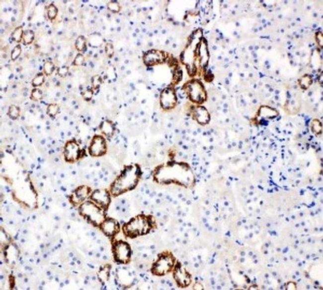 GLUT5 Antibody in Immunohistochemistry (Paraffin) (IHC (P))