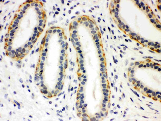 SLC6A4 Antibody in Immunohistochemistry (Paraffin) (IHC (P))