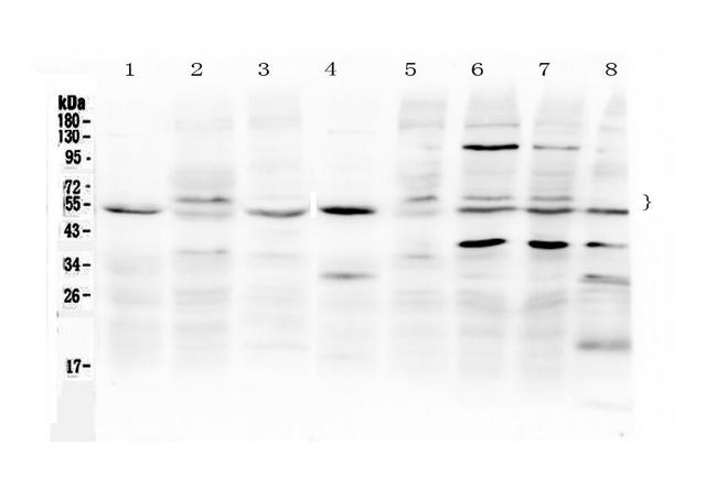 SMAD1/SMAD5 Antibody in Western Blot (WB)