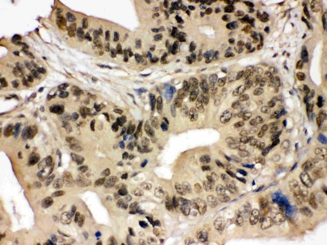 SMC3 Antibody in Immunohistochemistry (Paraffin) (IHC (P))