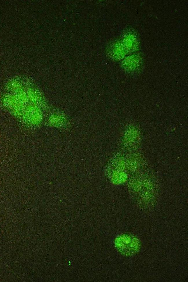 SMC6 Antibody in Immunocytochemistry (ICC/IF)