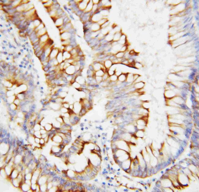 SPARC Antibody in Immunohistochemistry (Paraffin) (IHC (P))