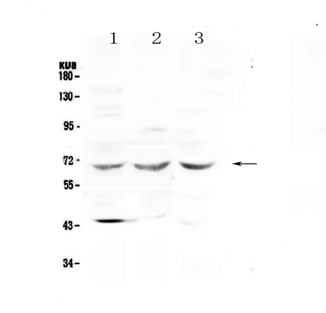 SPHK2 Antibody in Western Blot (WB)