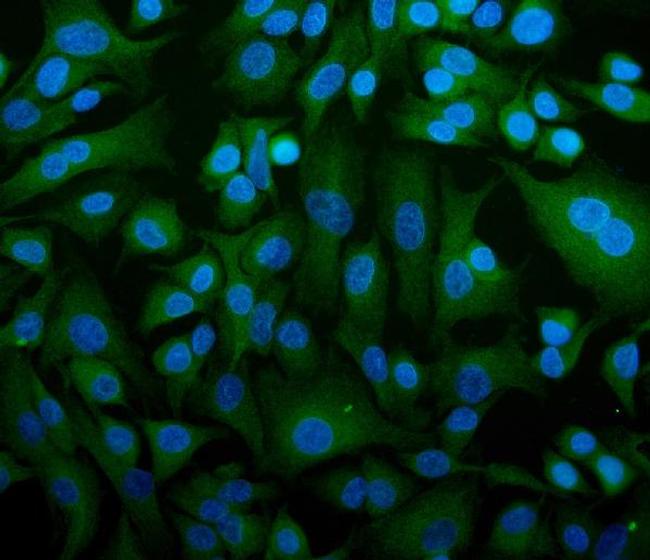 STIM1 Antibody in Immunocytochemistry (ICC/IF)