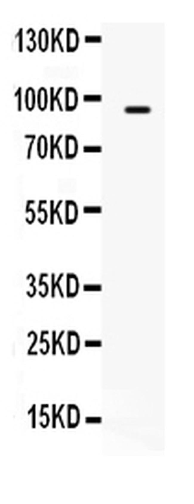 TAP2 Antibody in Western Blot (WB)