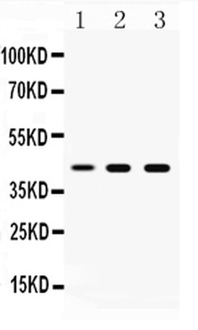 TAT Antibody in Western Blot (WB)