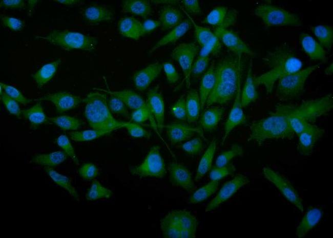 Tyrosine Hydroxylase Antibody in Immunocytochemistry (ICC/IF)