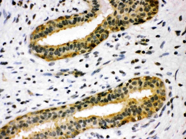 TIMP4 Antibody in Immunohistochemistry (Paraffin) (IHC (P))