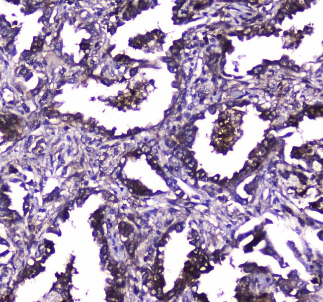 TLR1 Antibody in Immunohistochemistry (Paraffin) (IHC (P))