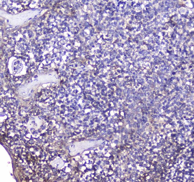 BCMA Antibody in Immunohistochemistry (Paraffin) (IHC (P))